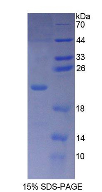 Human Recombinant Phospholipase C Beta 3, Phosphoinositide Specific (PLCb3)