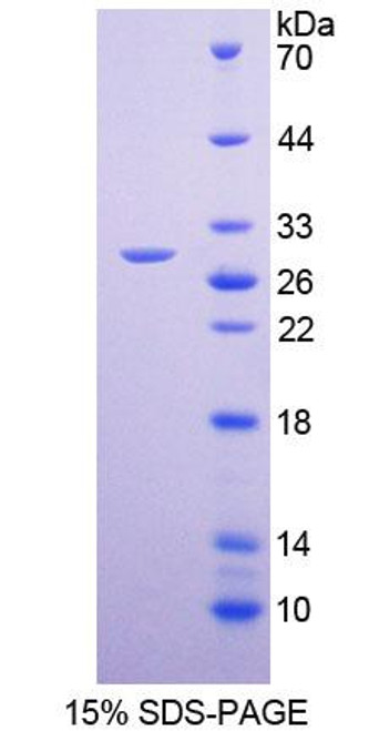 Human Recombinant Potassium Chloride Cotransporters 4 (KCC4)