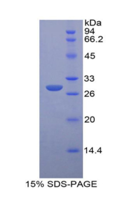 Rat Recombinant Insulin Like Growth Factor 2 Receptor (IGF2R)