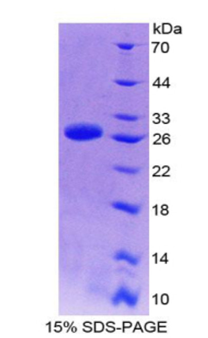 Human Recombinant Mitogen Activated Protein Kinase Activated Protein Kinase 3 (MAPKAPK3)