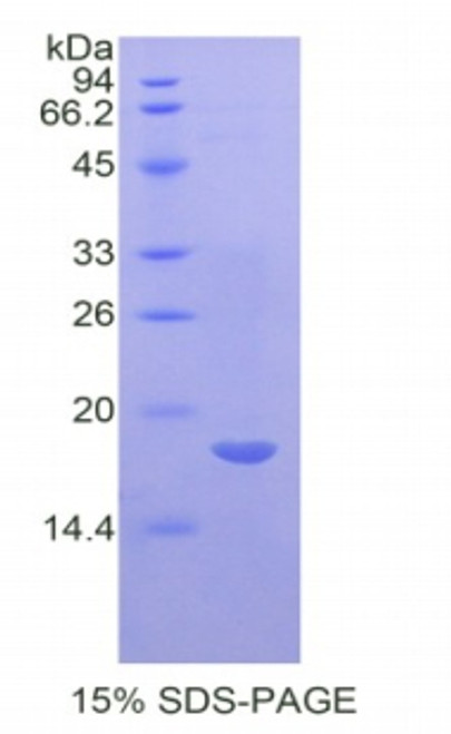 Human Recombinant Interleukin 17 Receptor A (IL17RA)