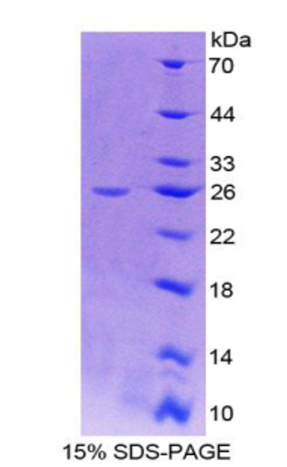 Human Recombinant Insulin Like Growth Factor 1 Receptor (IGF1R)