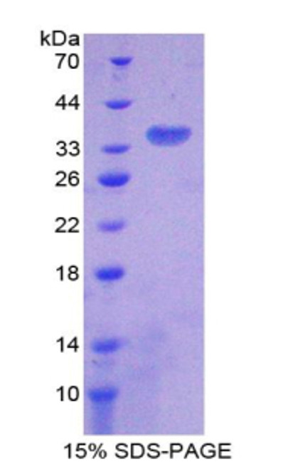 Human Recombinant Citrate Synthase (CS)