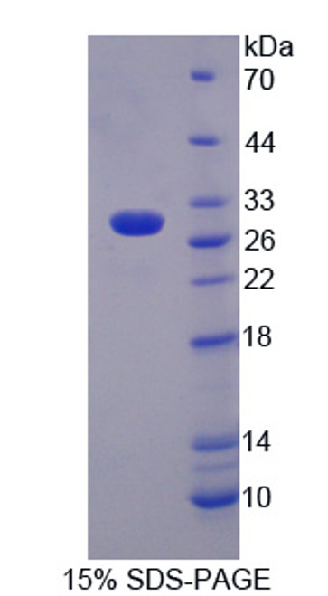 Rat Recombinant Lymphocyte Activation Gene 3 (LAG3)