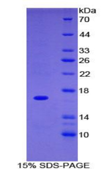 Rat Recombinant Integrin Alpha M (ITGaM)