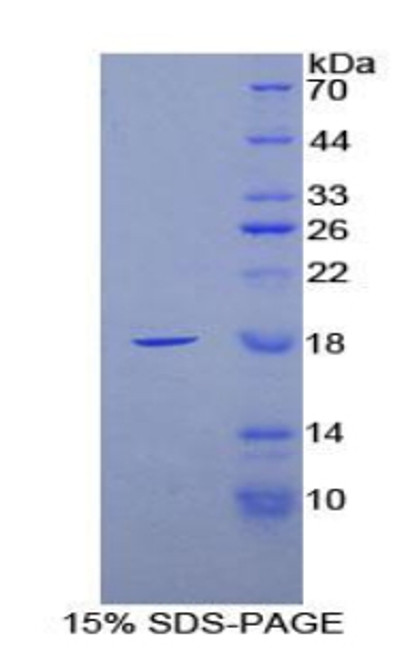 Rat Recombinant Fatty Acid Binding Protein 4, Adipocyte (FABP4)