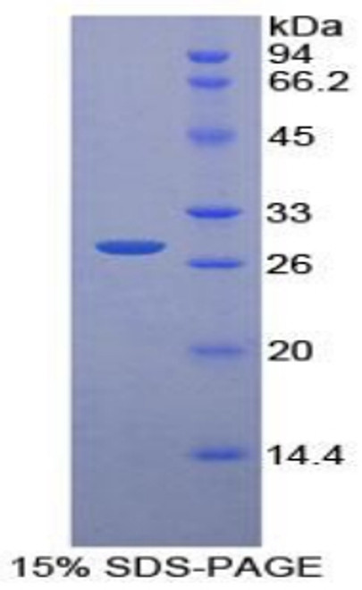 Rat Recombinant Pyridoxal Kinase (PDXK)