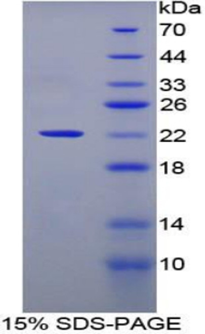 Human Recombinant C-Type Lectin Domain Family 4, Member M (CLEC4M)