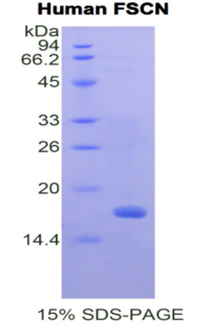 Human Recombinant Fascin (FSCN)