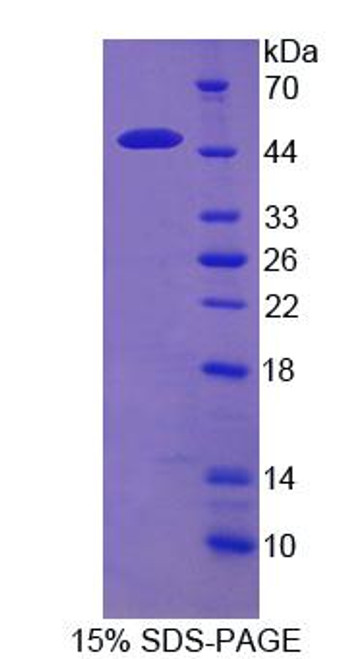 Mouse Recombinant Regenerating Islet Derived Protein 1 Alpha (REG1a)