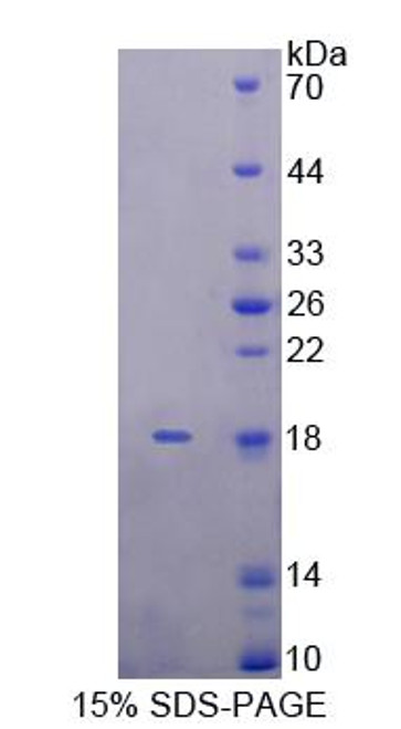 Rat Recombinant Killer Cell Lectin Like Receptor Subfamily K, Member 1 (KLRK1)