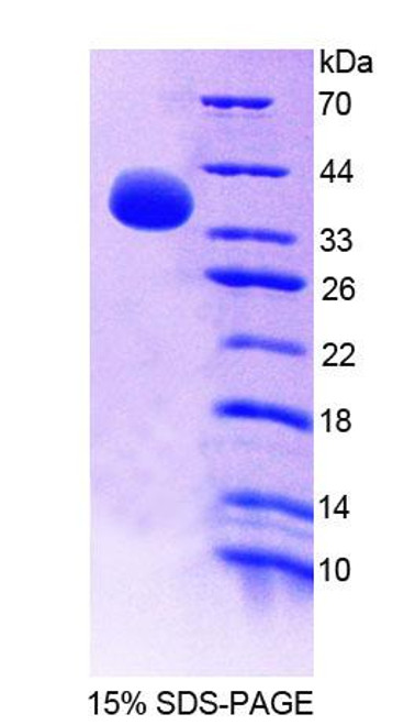 Human Recombinant Guanylate Binding Protein 4 (GBP4)