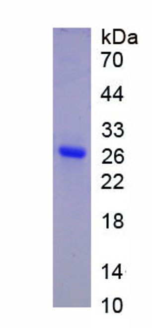 Human Recombinant Junctional Adhesion Molecule 1 (JAM1)