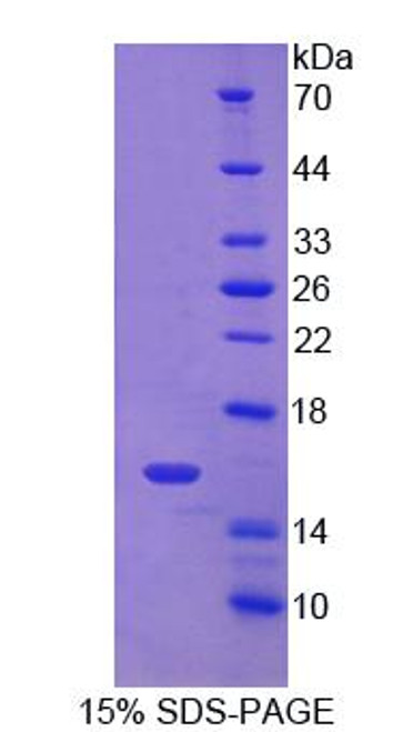 Human Recombinant Cluster Of Differentiation 7 (CD7)