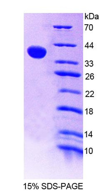 Mouse Recombinant Receptor Interacting Serine Threonine Kinase 2 (RIPK2)