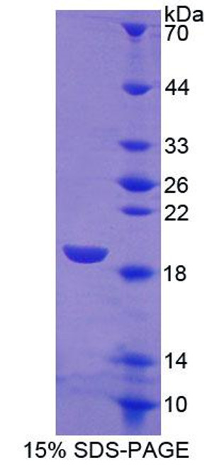 Human Recombinant Sialic Acid Binding Ig Like Lectin 7 (SIGLEC7) Human Recombinant Sialic Acid Binding Ig Like Lectin 7 (SIGLEC7)