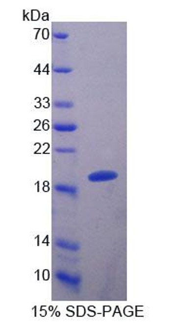 Cattle Recombinant S100 Calcium Binding Protein A8 (S100A8)