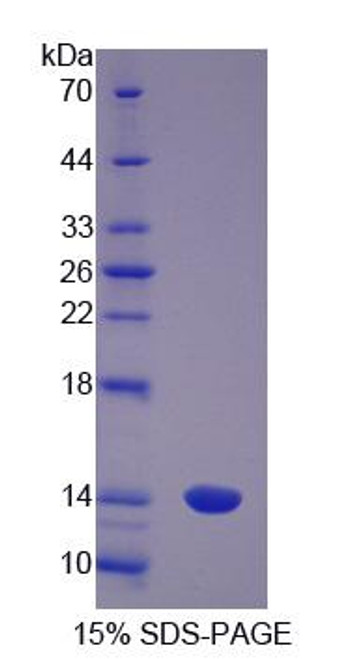 Pig Recombinant S100 Calcium Binding Protein A8 (S100A8)