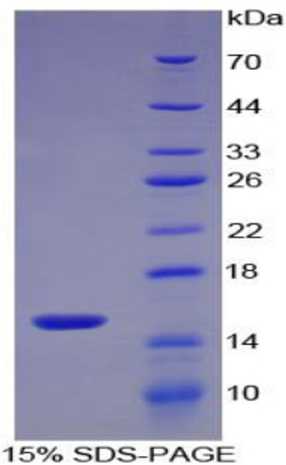 Mouse Recombinant S100 Calcium Binding Protein A9 (S100A9)