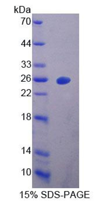 Human Recombinant Vitamin D Binding Protein (DBP)