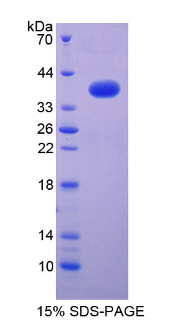 Chicken Recombinant Nuclear Factor Kappa B2 (NFkB2)