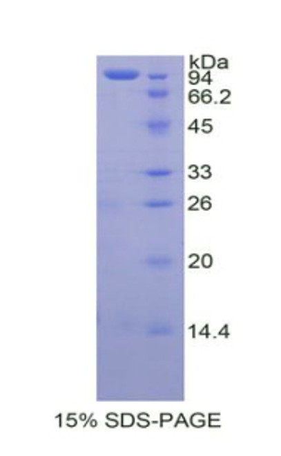 Human Recombinant Transglutaminase 2, Tissue (TGM2)