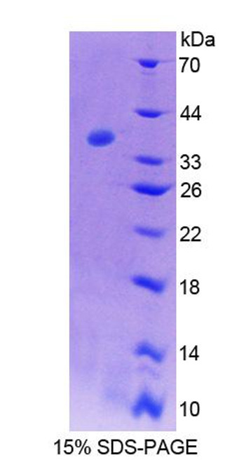 Cattle Recombinant Interleukin 2 Receptor Alpha (IL2Ra)