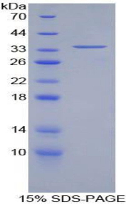 Rat Recombinant Lectin Like Oxidized Low Density Lipoprotein Receptor 1 (LOX1)