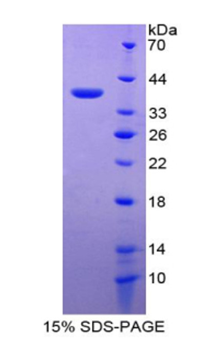 Rat Recombinant Metallothionein 2 (MT2)