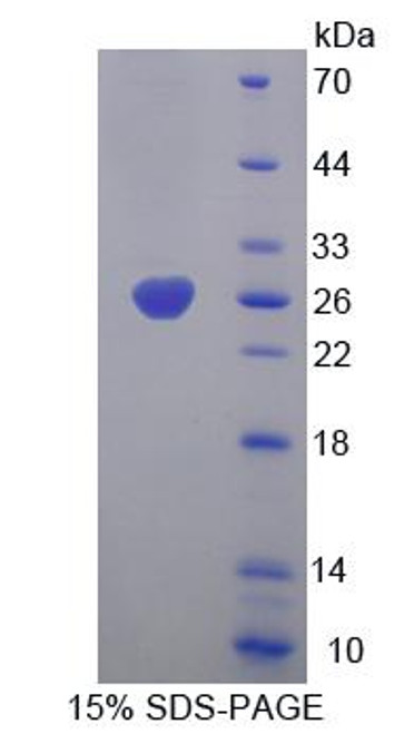 Mouse Recombinant Cholinergic Receptor, Nicotinic, Alpha 4 (CHRNa4)