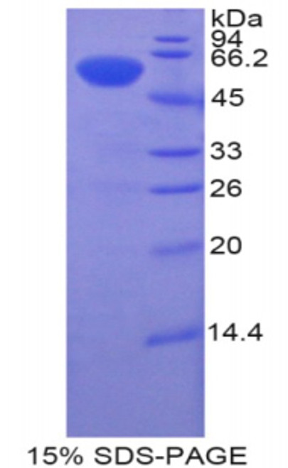 Human Recombinant Bruton'S Tyrosine Kinase (Btk)