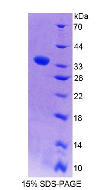 Rat Recombinant Wiskott Aldrich Syndrome Protein (WASP)