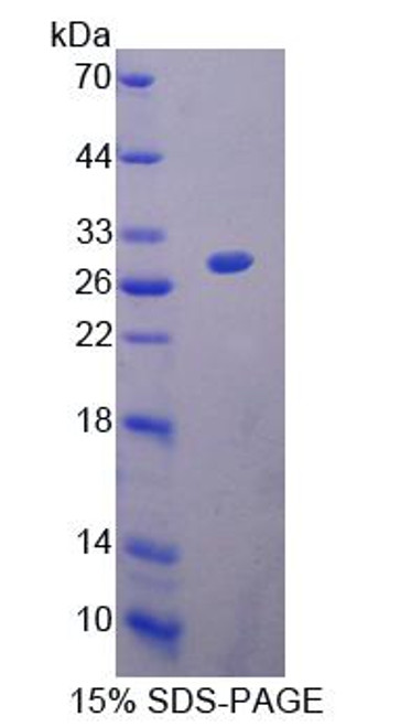 Mouse Recombinant Cholinergic Receptor, Nicotinic, Alpha 2 (CHRNa2)