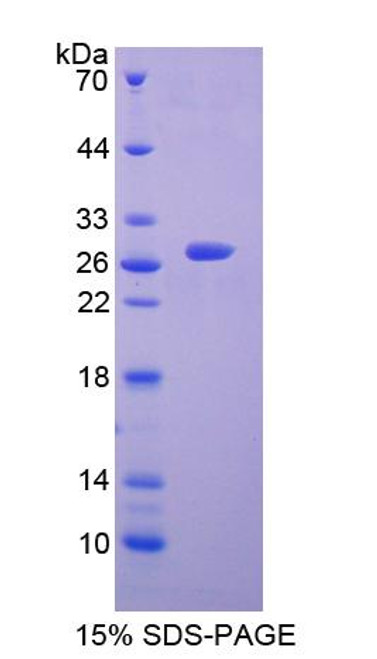 Human Recombinant Choline Acetyltransferase (ChAT)