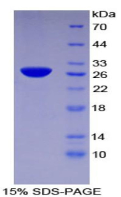 Human Recombinant Tissue Factor Pathway Inhibitor 2 (TFPI2)