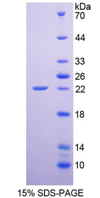 Rat Recombinant Epiregulin (EREG)