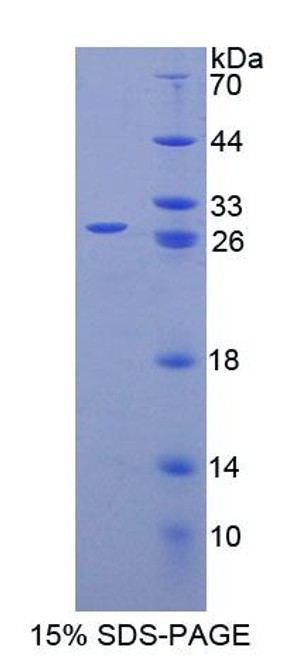 Mouse Recombinant Sperm Protein 17 (Sp17)