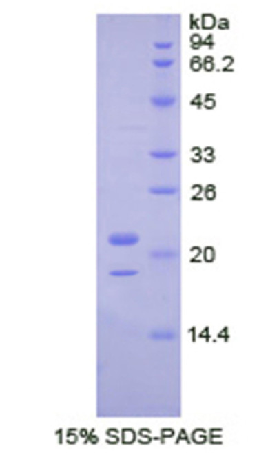 Human Recombinant Tar DNA Binding Protein 43kDa (TDP43)