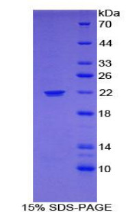 Mouse Recombinant Monoamine Oxidase A (MAOA)