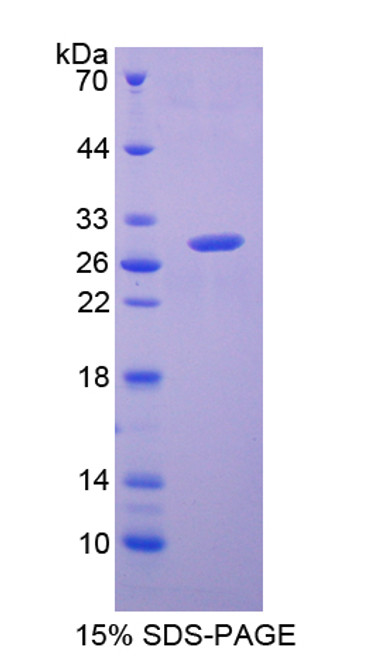 Mouse Recombinant Glutathione S Transferase Alpha 2 (GSTa2)