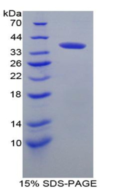 Mouse Recombinant Interferon Regulatory Factor 6 (IRF6)