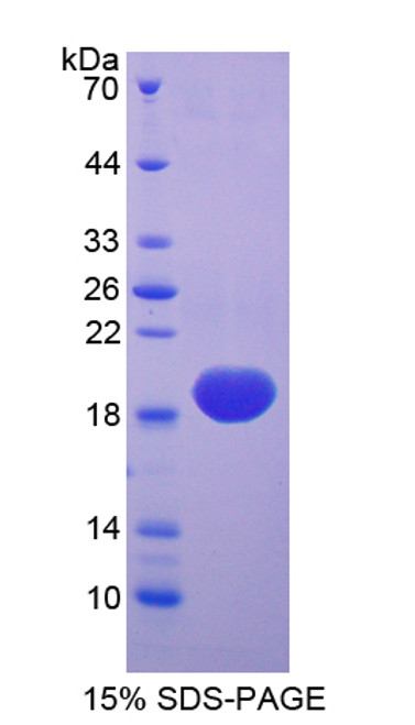 Chicken Recombinant Superoxide Dismutase 1, Soluble (SOD1)