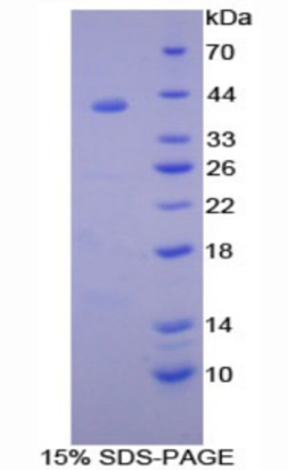 Rat Recombinant Syndecan 1 (SDC1)