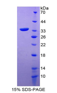Human Recombinant Tyrosine Kinase Activator Protein 1 (TKA1)