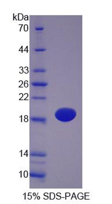 Pig Recombinant Fatty Acid Binding Protein 5, Epidermal (FABP5)