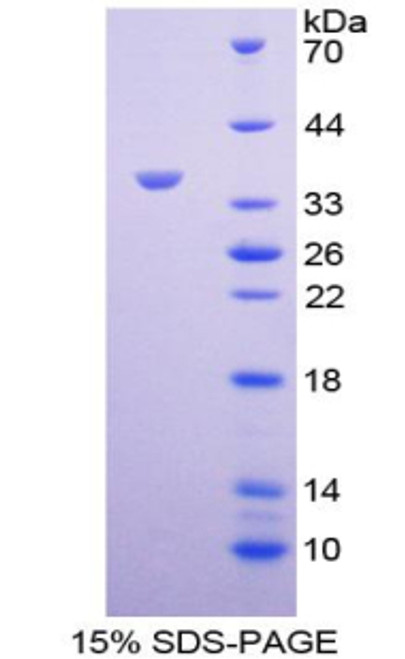 Human Recombinant Cadherin 17 (CDH17)