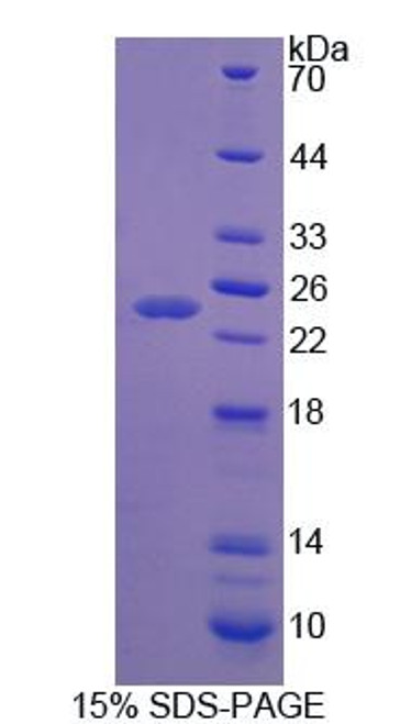 Rat Recombinant Apolipoprotein B (APOB)