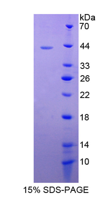 Cattle Recombinant S100 Calcium Binding Protein A2 (S100A2)