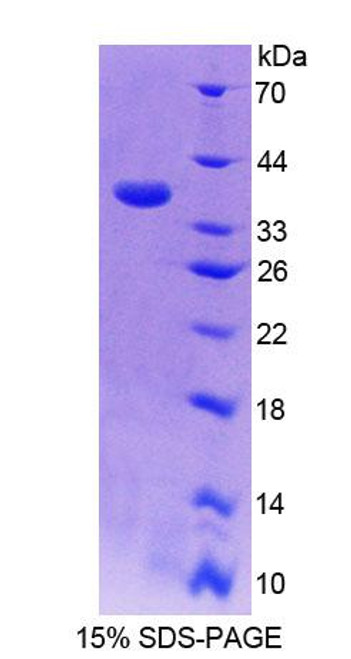 Rat Recombinant 17-Alpha-Hydroxylase (S17aH)