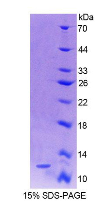 Human Recombinant S100 Calcium Binding Protein A4 (S100A4)